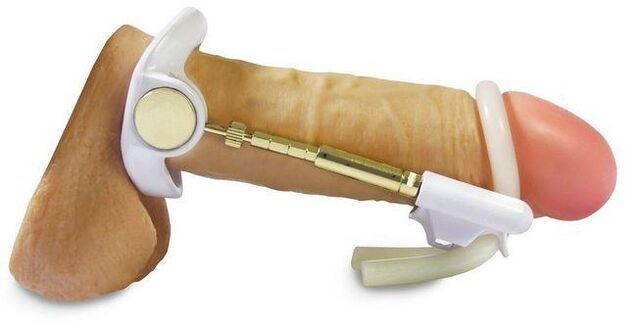 लिंग के सिर को बड़ा करने के लिए विस्तारक