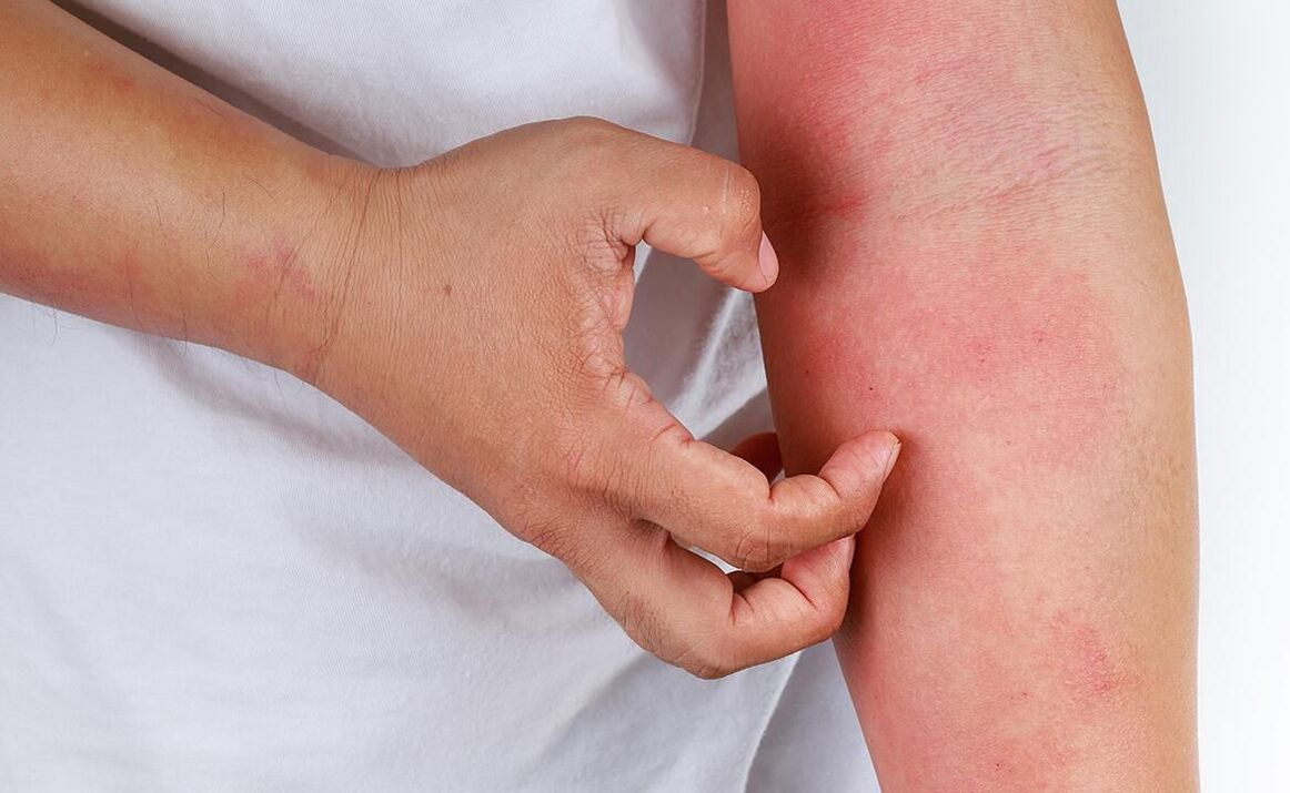 सोडा के उपयोग से संभावित जटिलताएँ